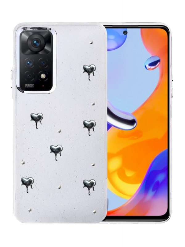 Redmi Note 11 Pro Fiyonk Desenli Kapak - Desen 1&hellip;