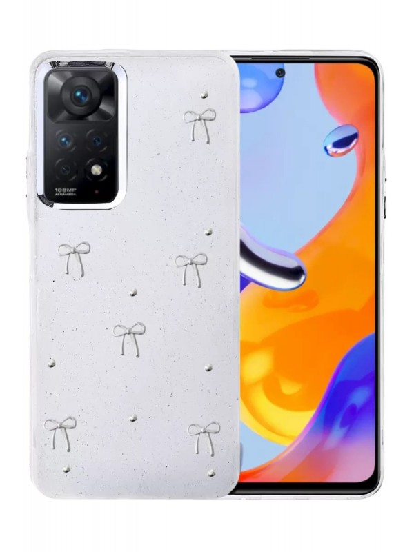 Redmi Note 11 Pro Fiyonk Desenli Kapak - Desen 5&hellip;